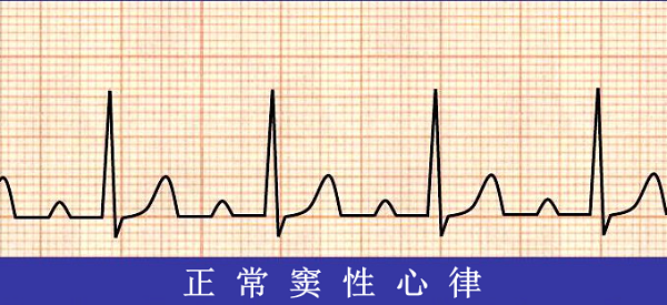 救命神器AED有多重要——你認(rèn)識它嗎？(圖6)